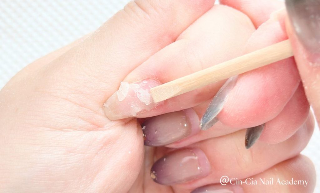 ウッドスティックで除去する